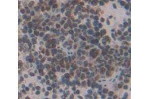 IHC-P analysis of Mouse Tissue, with DAB staining.