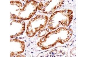 Immunohistochemical analysis of paraffin-embedded human kidney section using INSRR antibody; Ab was diluted at 1:25 dilution. (INSRR anticorps  (AA 668-702))