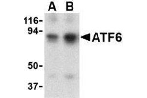 Western blot analysis of ATF6 in MDA-MB-361 cell lysate with this product atF6 antibody at (A) 0. (ATF6 anticorps  (N-Term))