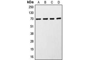 Western blot analysis of S6K1 expression in MCF7 (A), HeLa (B), HEK293 (C), mouse brain (D) whole cell lysates. (RPS6KB1 anticorps  (C-Term))