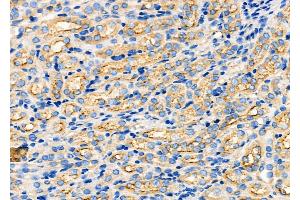ABIN6260054 and ABIN6272249 at 1/100 staining Mouse kidney tissue by IHC-P. (ARRDC1 anticorps  (C-Term))