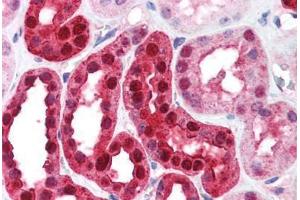 Human Kidney (formalin-fixed, paraffin-embedded) stained with CA2 antibody ABIN214579 at 5 ug/ml followed by biotinylated goat anti-rabbit IgG secondary antibody ABIN481713, alkaline phosphatase-streptavidin and chromogen. (CA2 anticorps)