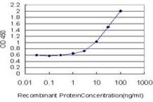 Detection limit for recombinant GST tagged GALT is approximately 0.