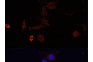 Immunofluorescence analysis of PC12 cells using WDR81 Polyclonal Antibody at dilution of 1:100. (WDR81 anticorps)