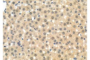 ABIN6264613 and ABIN6277733 at 1/100 staining Rat liver tissue by IHC-P. (RAD21 anticorps  (C-Term))