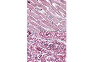 Immunohistochemical (Formalin/PFA-fixed paraffin-embedded sections) staining in human heart (A) and human adrenal gland (B) with SSTR5 polyclonal antibody . (SSTR5 anticorps  (2nd Extracellular Domain))