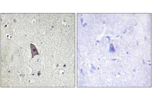 Immunohistochemistry analysis of paraffin-embedded human brain, using TIE2 (Phospho-Tyr1102) Antibody. (TEK anticorps  (pTyr1102))