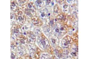 Used in DAB staining on fromalin fixed paraffin-embedded Liver tissue