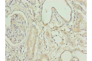 Immunohistochemistry of paraffin-embedded human kidney tissue using ABIN7158525 at dilution of 1:100 (ACSBG1 anticorps  (AA 351-600))
