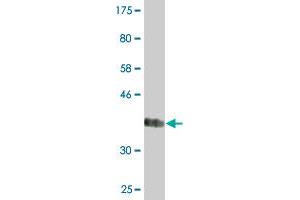 Western Blot detection against Immunogen (37.