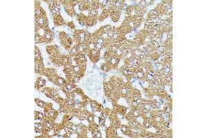 Immunohistochemistry of paraffin-embedded rat liver using MK1 antibody (ABIN7268647) at dilution of 1:100 (40x lens).