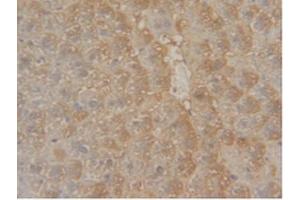 IHC-P analysis of Mouse Liver Tissue, with DAB staining. (GSTM1 anticorps  (AA 1-218))