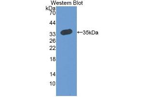 Western blot analysis of the recombinant protein. (RCN2 anticorps  (AA 26-301))