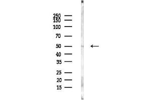 anti-Lysophosphatidylcholine Acyltransferase 2 (LPCAT2) (N-Term) antibody