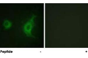 Immunofluorescence analysis of HUVEC cells, using KIF20A polyclonal antibody . (KIF20A anticorps)
