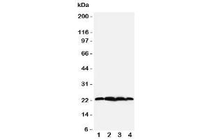 Western blot testing of BAG2 antibody (BAG2 anticorps  (N-Term))