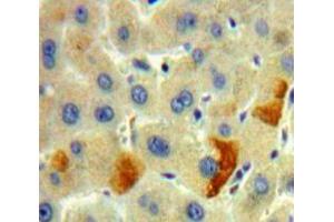 Used in DAB staining on fromalin fixed paraffin-embedded Liver tissue