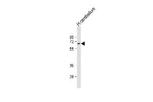 Anti-UGT2B4 Antibody (Center)at 1:2000 dilution + human cerebellum lysates Lysates/proteins at 20 μg per lane. (UGT2B4 anticorps  (AA 338-370))