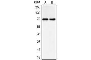 Western blot analysis of BLNK expression in Raji (A), LOVO (B) whole cell lysates. (B-Cell Linker anticorps  (Center))