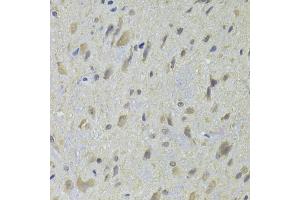 Immunohistochemistry of paraffin-embedded rat spinal cord using HDAC4 Antibody (ABIN5975864) at dilution of 1/100 (40x lens). (HDAC4 anticorps)