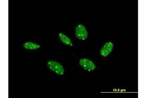 Immunofluorescence of purified MaxPab antibody to COIL on HeLa cell. (Coilin anticorps  (AA 1-576))