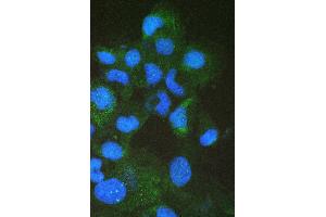 anti-Fatty Acid Binding Protein 2, Intestinal (FABP2) (AA 2-38), (N-Term) antibody