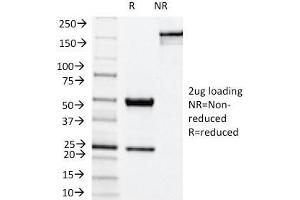 SDS-PAGE Analysis Purified NOX4 Mouse Monoclonal Antibody (NOX4/1245). (NADPH Oxidase 4 anticorps)