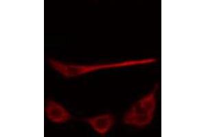 ABIN6274794 staining MCF7 cells by IF/ICC. (ABHD9 anticorps  (N-Term))