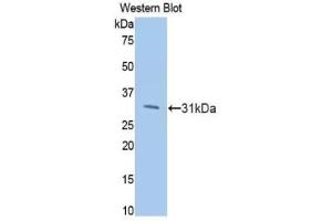 Western blot analysis of the recombinant protein. (PIK3CB anticorps  (AA 807-1070))