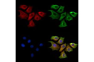 ABIN6261453 and ABIN6269282 staining HepG2 cells by IF/ICC. (EFNB1/2 (C-Term) anticorps)