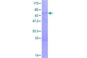 Image no. 1 for Desert Hedgehog (DHH) (AA 1-396) protein (GST tag) (ABIN1351543)