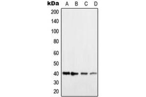 Western blot analysis of Histamine H2 Receptor expression in HEK293T (A), COLO205 (B), NIH3T3 (C), H9C2 (D) whole cell lysates. (HRH2 anticorps  (Center))