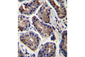 SLC9A2 Antibody immunohistochemistry analysis in formalin fixed and paraffin embedded human stomach tissue followed by peroxidase conjugation of the secondary antibody and DAB staining. (SLC9A2 anticorps  (C-Term))