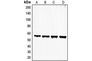 Western blot analysis of FGL2 expression in HeLa (A), Jurkat (B), HuT78 (C), Molt4 (D) whole cell lysates. (FGL2 anticorps  (N-Term))
