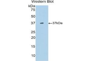 Western blot analysis of the recombinant protein. (CXCL13 anticorps  (AA 22-109))