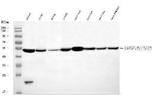 Western blot analysis of ATP5F1B using anti-ATP5F1B antibody (ABIN7599866). (Atp5f1b (AA 123-529) anticorps)