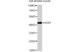 Western blot analysis of extracts of rat skeletal muscle, using AGXT antibody (ABIN6291533) at 1:1000 dilution. (AGXT anticorps)