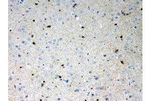 IHC analysis of HCN2 using anti- HCN2 antibody .