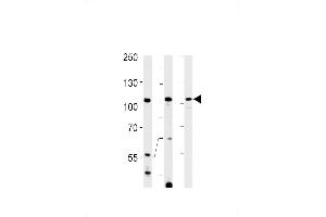 Western blot analysis in Hela，K562 cell line and rat spleen tissue lysates (35ug/lane). (TFIP11 anticorps  (N-Term))