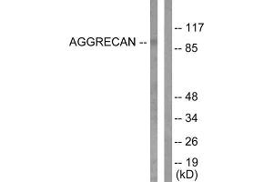 Western blot analysis of extracts from Jurkat cells, treated with Etoposide (25uM, 60mins), using Aggrecan (Cleaved-Asp369) antibody (ABIN5978446).