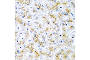 Immunohistochemistry of paraffin-embedded human liver injury using WNT2 antibody at dilution of 1:200 (40x lens). (WNT2 anticorps)