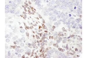 Immunohistochemistry (IHC) image for anti-Lamin A/C (LMNA) (AA 550-600) antibody (ABIN7454915)