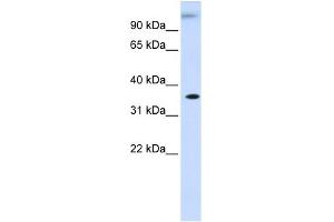 WB Suggested Anti-DHDH Antibody Titration: 0. (DHDH anticorps  (Middle Region))