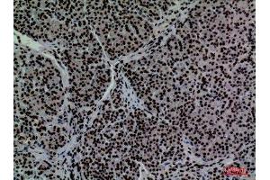 Immunohistochemistry (IHC) analysis of paraffin-embedded Human Pancreas, antibody was diluted at 1:100. (CD2 anticorps  (N-Term))