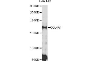 Western blot analysis of extracts of U-87 MG cells, using COL4A1 Antibody (ABIN5997482) at 1:3000 dilution. (COL4A1 anticorps)