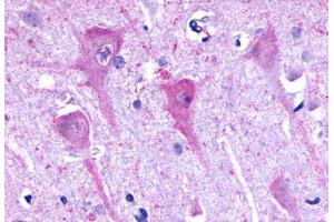 Anti-P2RY8 / P2Y8 antibody  ABIN1049223 IHC staining of human brain, neurons and glia. (P2RY8 anticorps  (C-Term))
