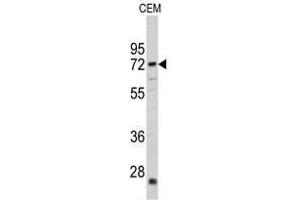 Image no. 1 for anti-Carnitine O-Acetyltransferase (CRAT) (N-Term) antibody (ABIN452873) (CRAT anticorps  (N-Term))
