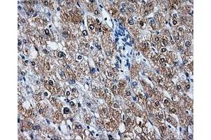 Immunohistochemical staining of paraffin-embedded liver tissue using anti-LEMD3mouse monoclonal antibody.