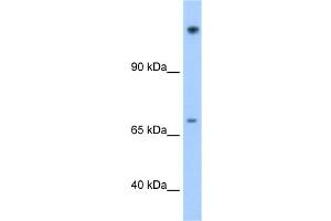 WB Suggested Anti-FAM129A Antibody Titration:  1. (Niban anticorps  (N-Term))