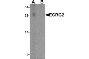 Western blot analysis of ECRG2 in human lung tissue lysate with ECRG2 Antibody  at 1 ug/mL in (A) the absence and (B) the presence of blocking peptide.